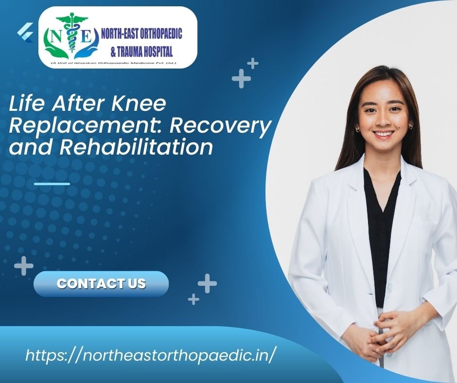 Life After Knee Replacement: Recovery and Rehabilitation