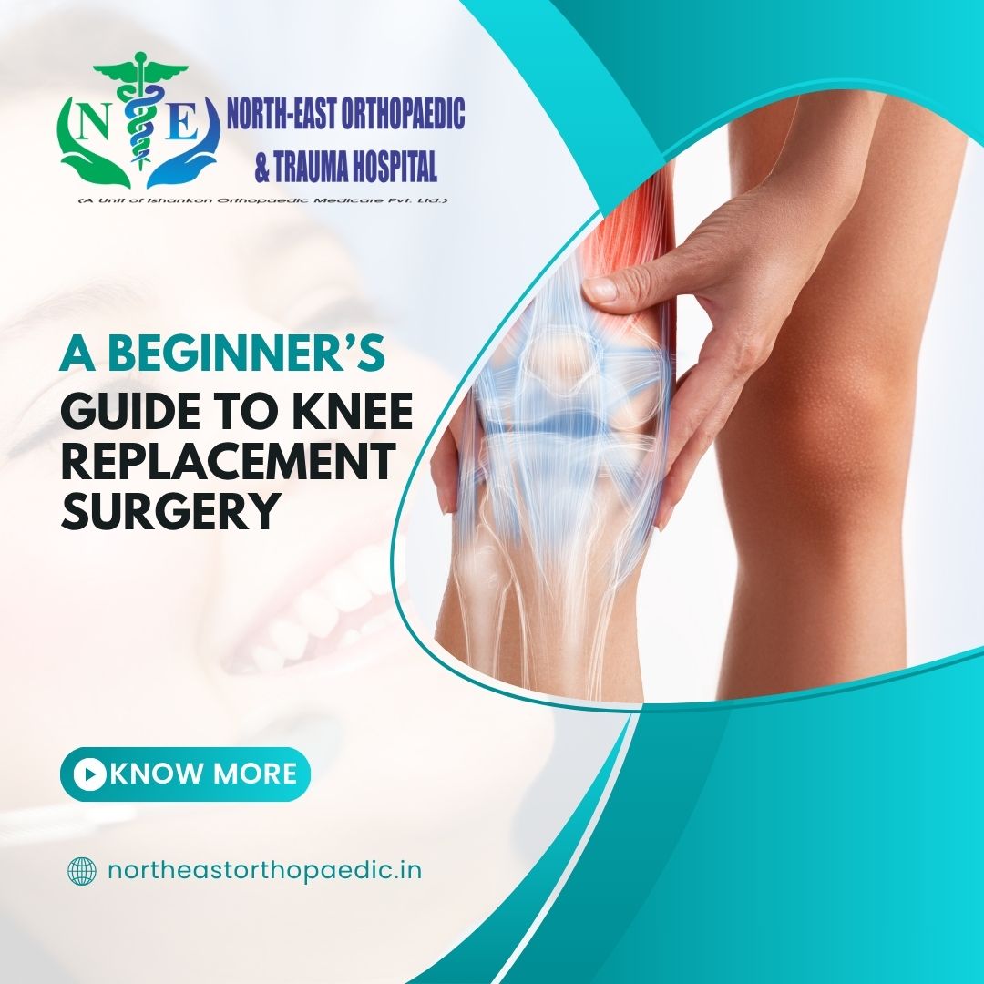 Knee-Replacement-Surgery- in-payna