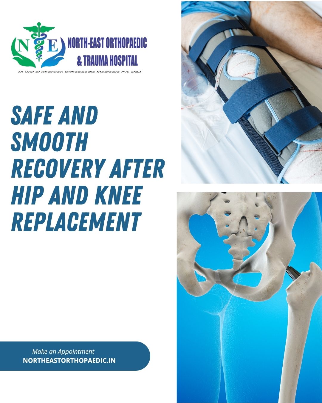 Safe and Smooth Recovery After Hip and Knee Replacement